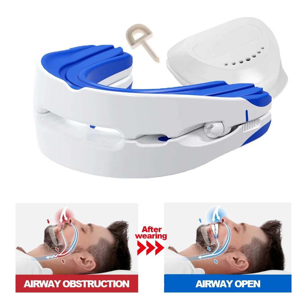 Adjustable Anti Snoring Mouth Guard Braces Anti-Snoring Device Man Snoring Stopper for Improve Sleep Quality Better Breath